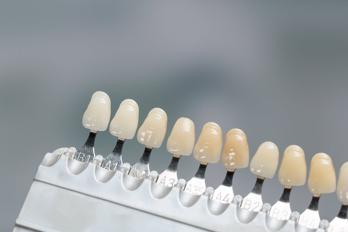 Close up of shade guide to check veneer of tooth crown in a dental laboratory